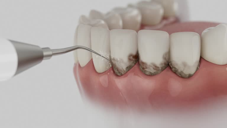 Reliable Dental contractor in Robins, IA by Smile Center Dentistry